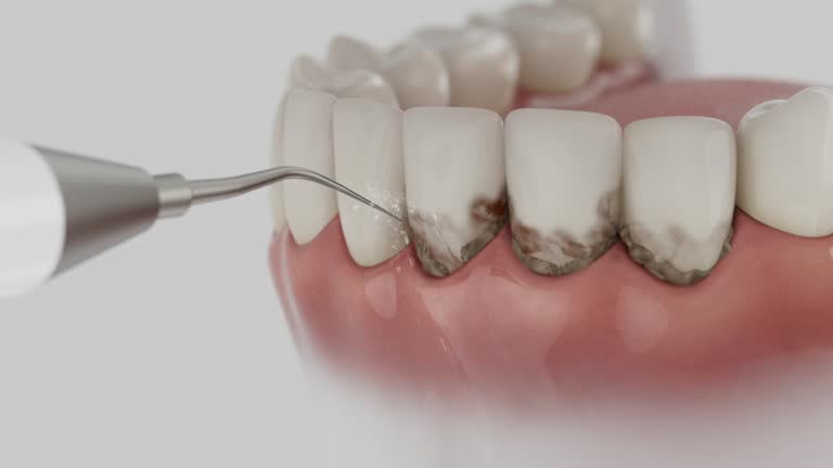 Reliable Dental Implants contractor in Spring Hill, KS by Smile Center Dentistry
